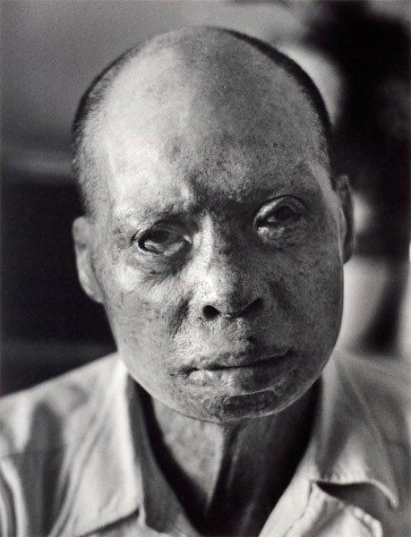 Christer Strömholm, "Hiroshima-sviten", 1963 (22 parts).