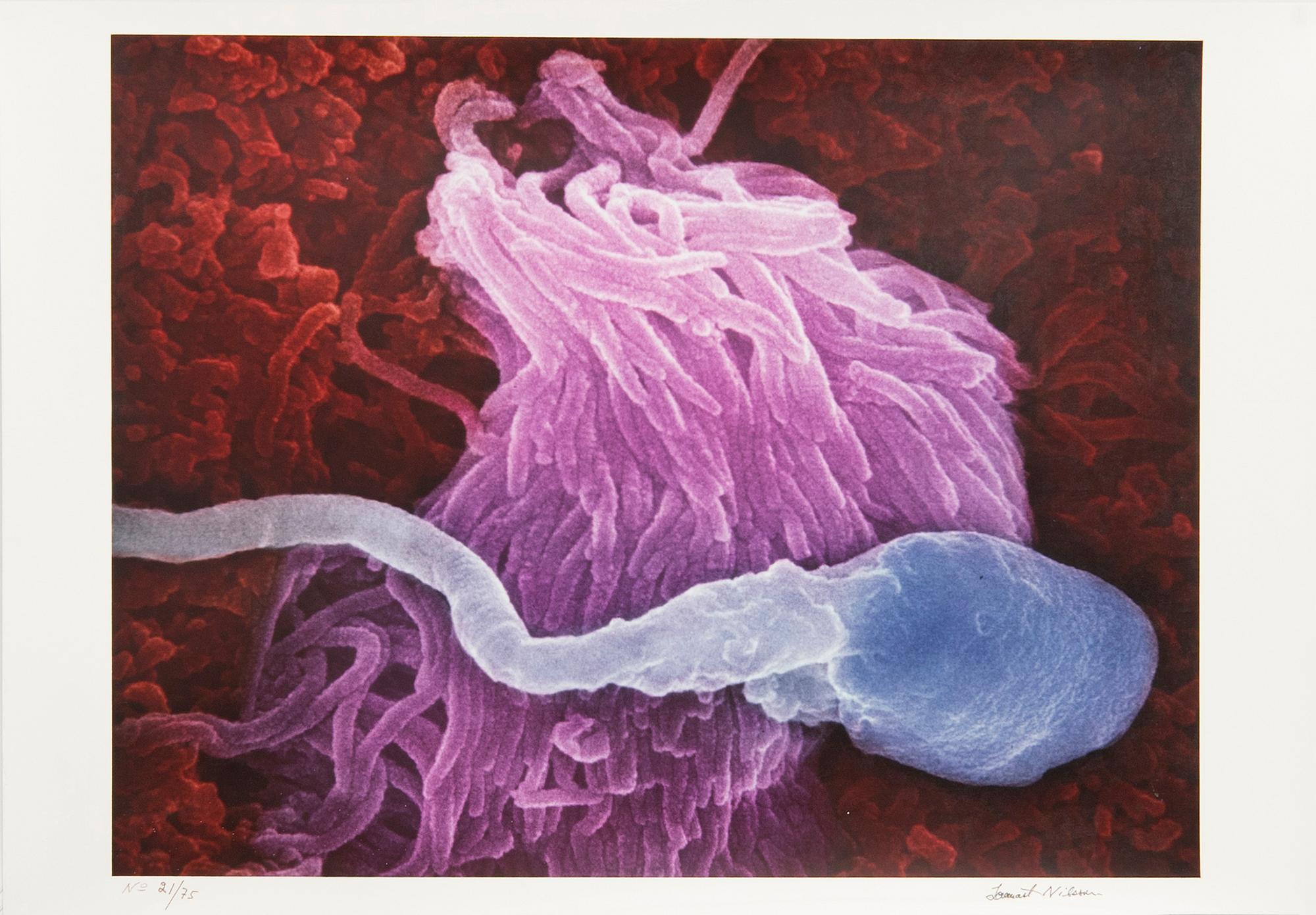 Lennart Nilsson, Spermie i äggledare, 1974.