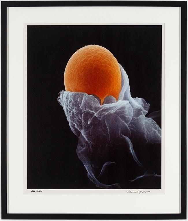 LENNART NILSSON, a cibachrome, signed.