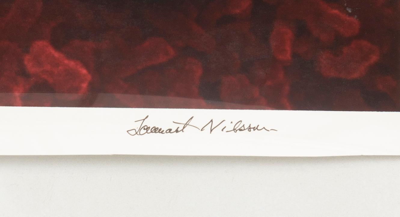 Lennart Nilsson, Spermie i äggledare, 1974.