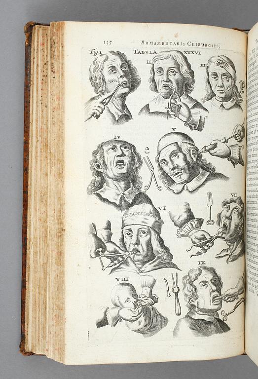 JOHAN SCULTETI, Armamentarium Chirurgicum, Haag 1657.