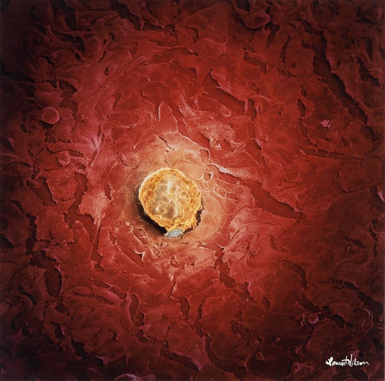Lennart Nilsson, Blastocyst, en befruktad mänsklig äggcell, 1990.