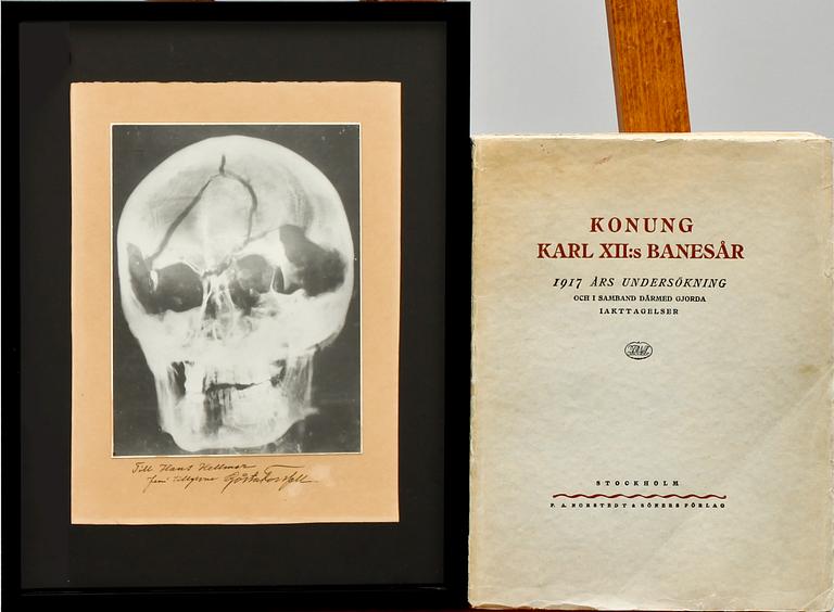 RÖNTGENBILD av Karl XII, silvergelatinfotografi.