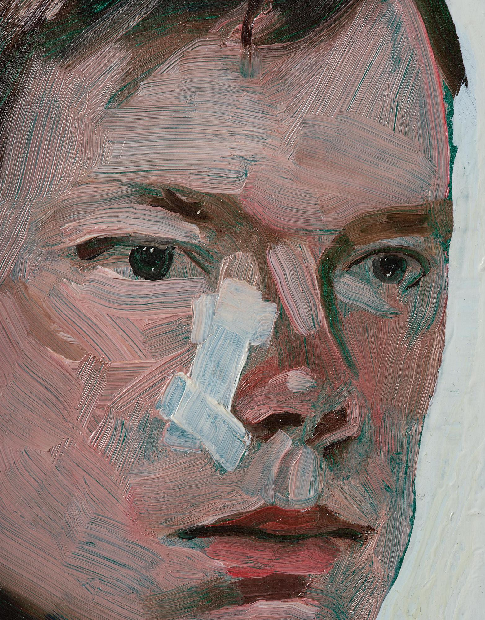 Ola Pehrson, "Fredrik - Pojke med plåster".