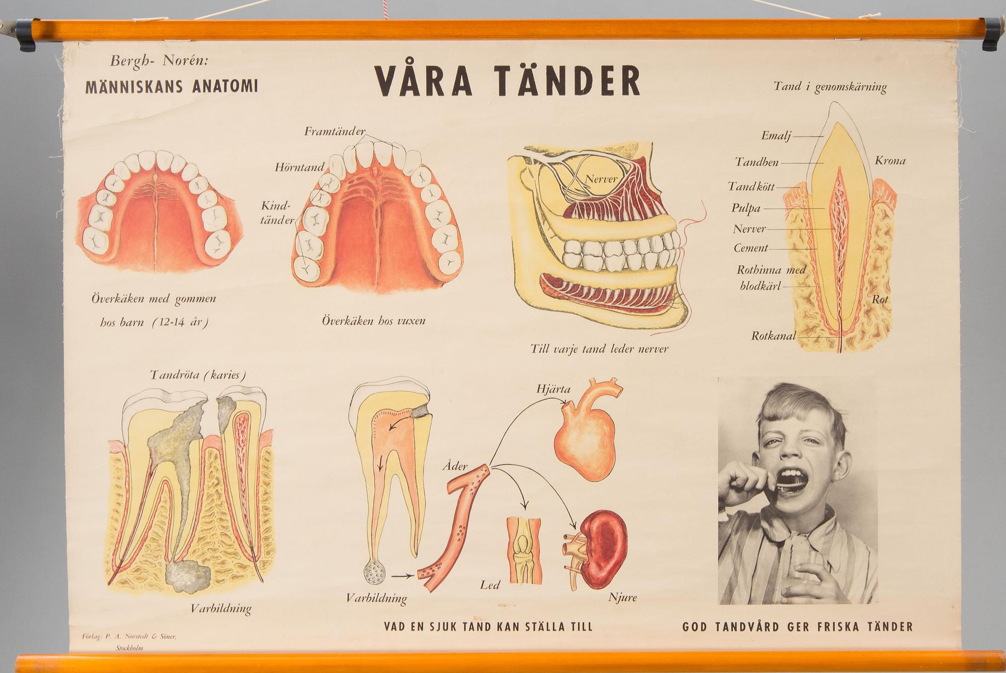 SKOLPLANSCHER, 2 st. Anatomiska motiv.