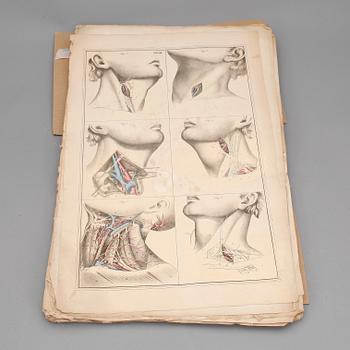 BOK, "Akiurgische abbildungen...der blutigen..operationen..", Dr. Ernst Blasius, Berlin 1833.