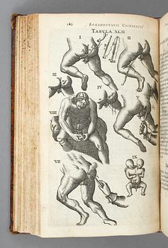 JOHAN SCULTETI, Armamentarium Chirurgicum, Haag 1657.