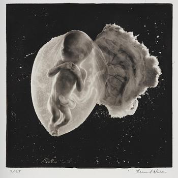 461. Lennart Nilsson, "Foster, 18 veckor", 1965.
