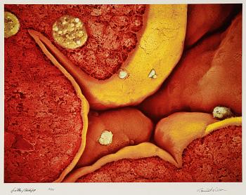 Lennart Nilsson, photo, signed 12/75.