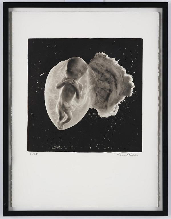 Lennart Nilsson, "Foster, 18 veckor", 1965.