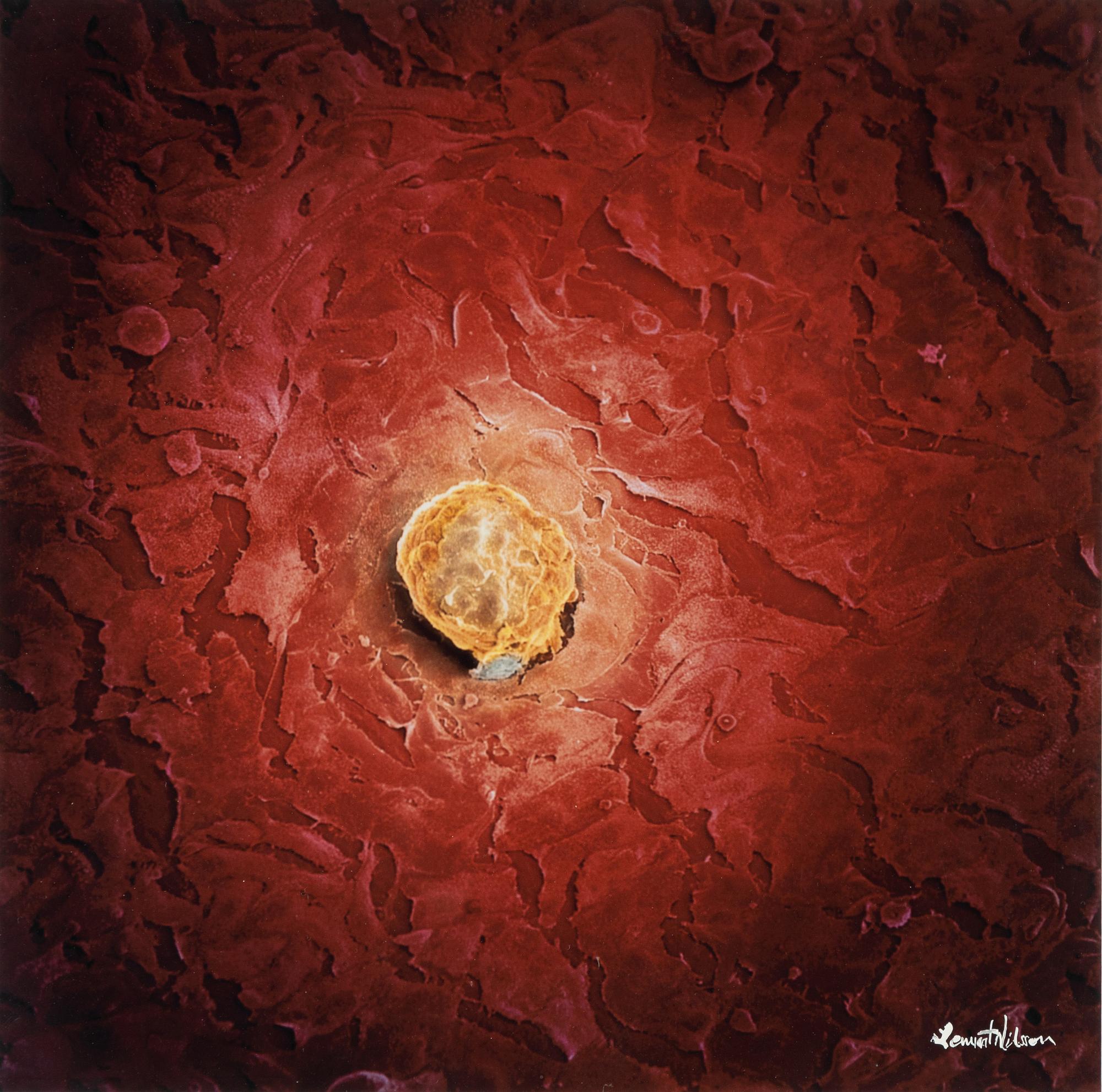 Lennart Nilsson, Impregnated human egg cell, 1990.