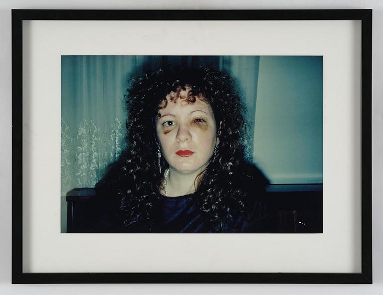 Nan Goldin, "Nan, One Month After Being Battered", 1984.