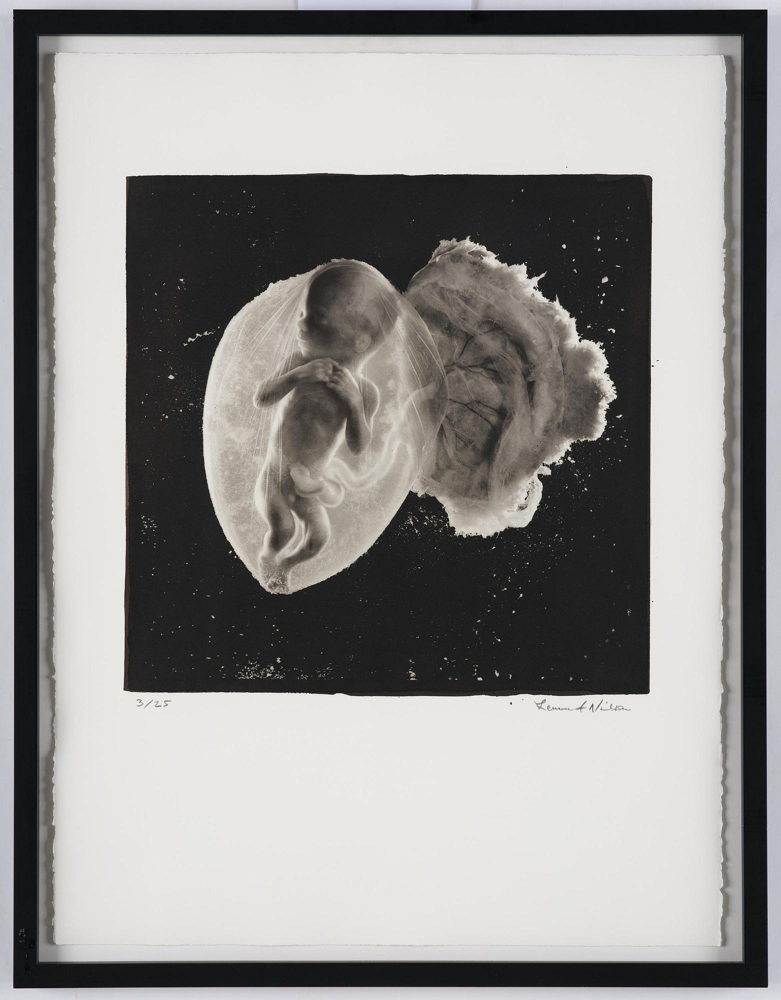 Lennart Nilsson, "Foster, 18 veckor", 1965.