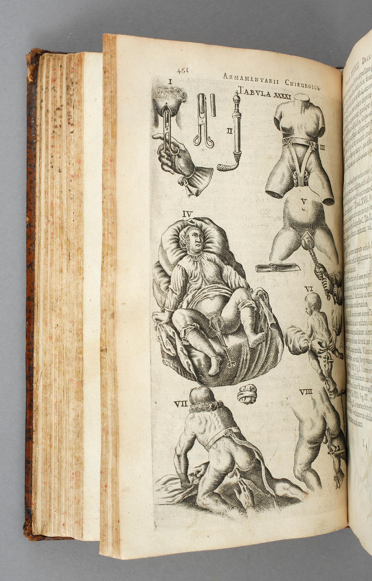 JOHAN SCULTETI, Armamentarium Chirurgicum, Haag 1657.