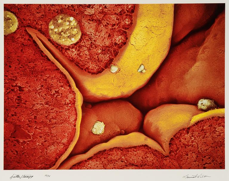 Lennart Nilsson, photo, signed 12/75.
