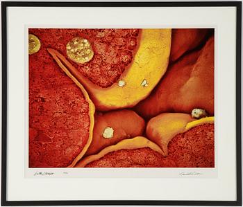 Lennart Nilsson, photo, signed 12/75.
