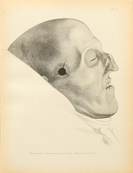 RÖNTGENBILD av Karl XII, silvergelatinfotografi.