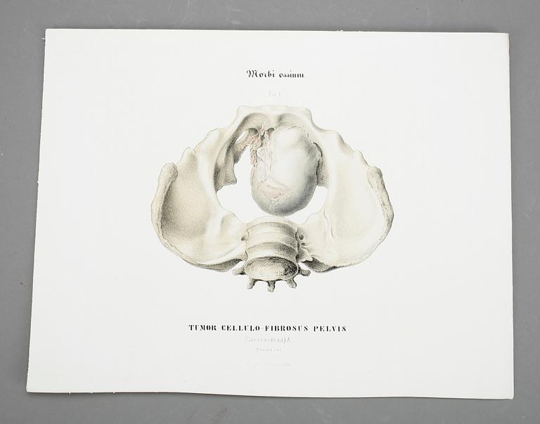 BILDMAPP, 12st, färglitografiska planscher. "Museum Anatomicum", Anders Retzius, 1855.