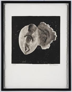 Lennart Nilsson, "Foster, 18 veckor", 1965.