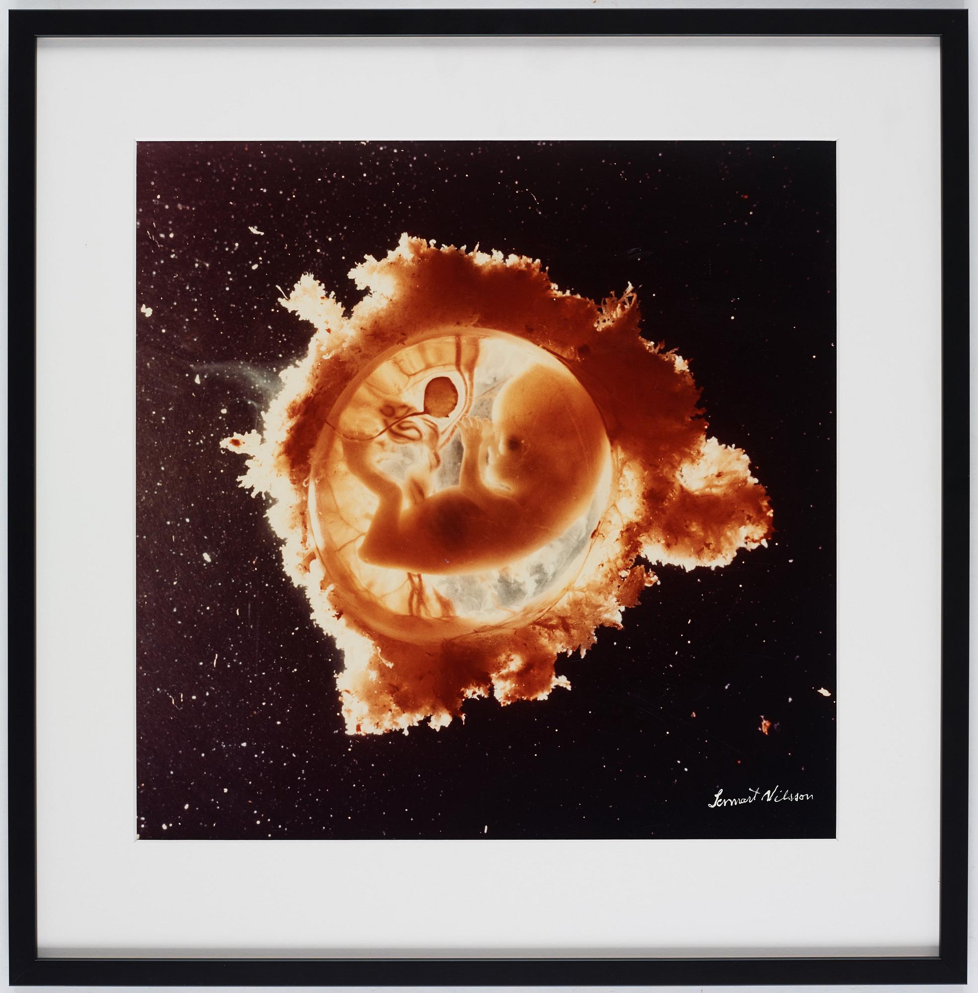 Lennart Nilsson, "Rymdfararen", 1965.