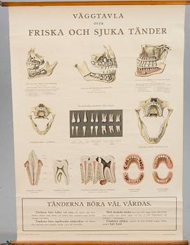 SKOLPLANSCH, 2 st, bland annat "Väggtavla övfer Friska och Sjuka tänder" 1925.