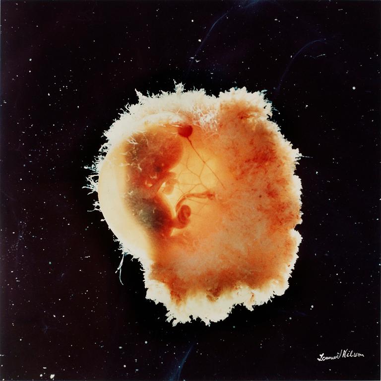 Lennart Nilsson, Foster.