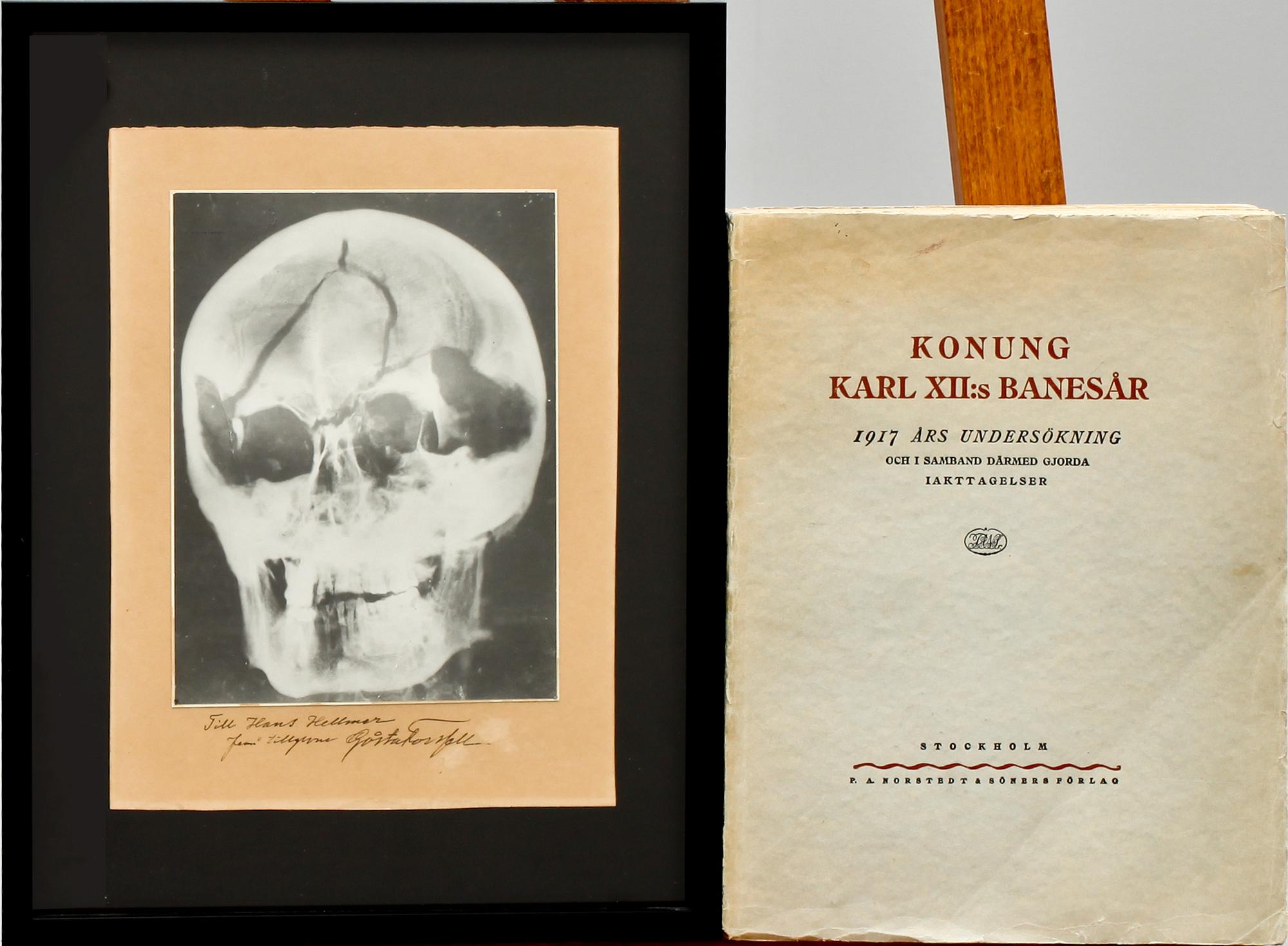 RÖNTGENBILD av Karl XII, silvergelatinfotografi.