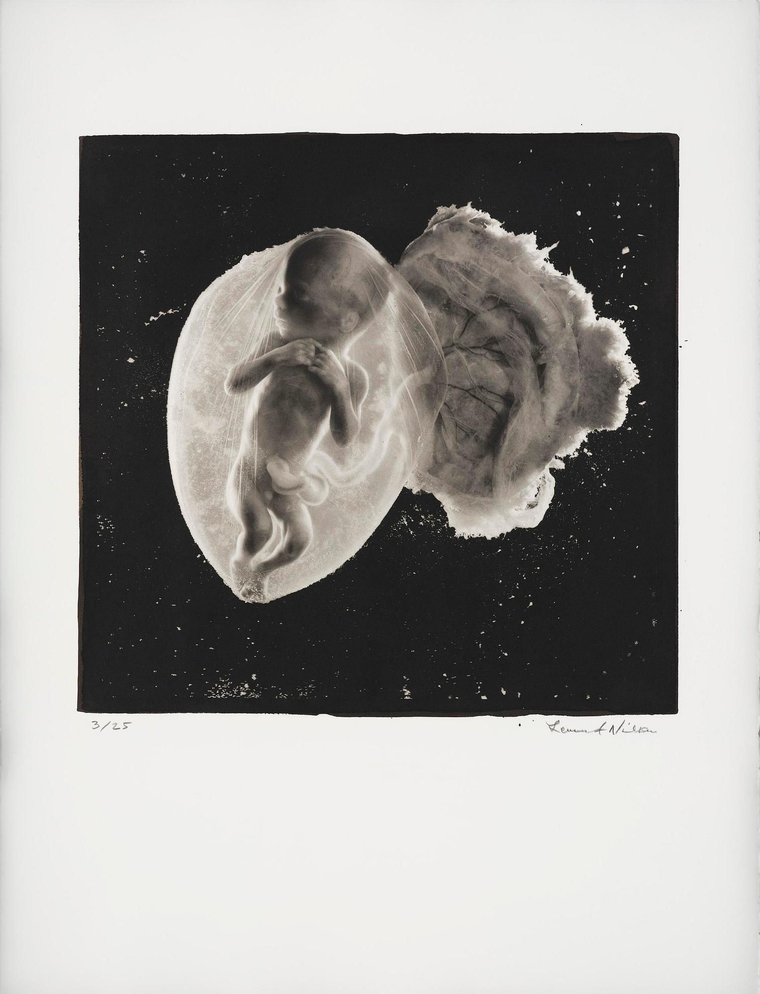 Lennart Nilsson, "Foster, 18 veckor", 1965.