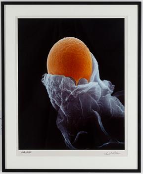 LENNART NILSSON, a cibachrome, signed.